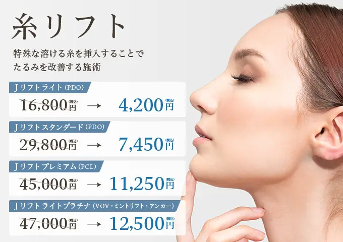 糸リフト