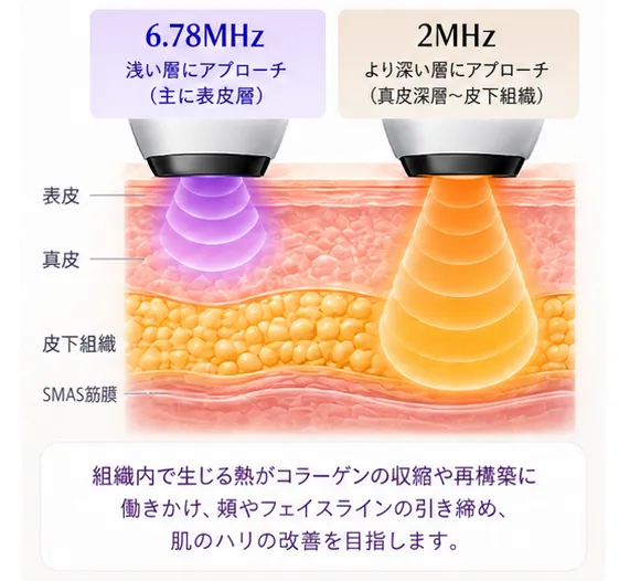 2種類の高周波で、異なる深さへのアプローチを検討